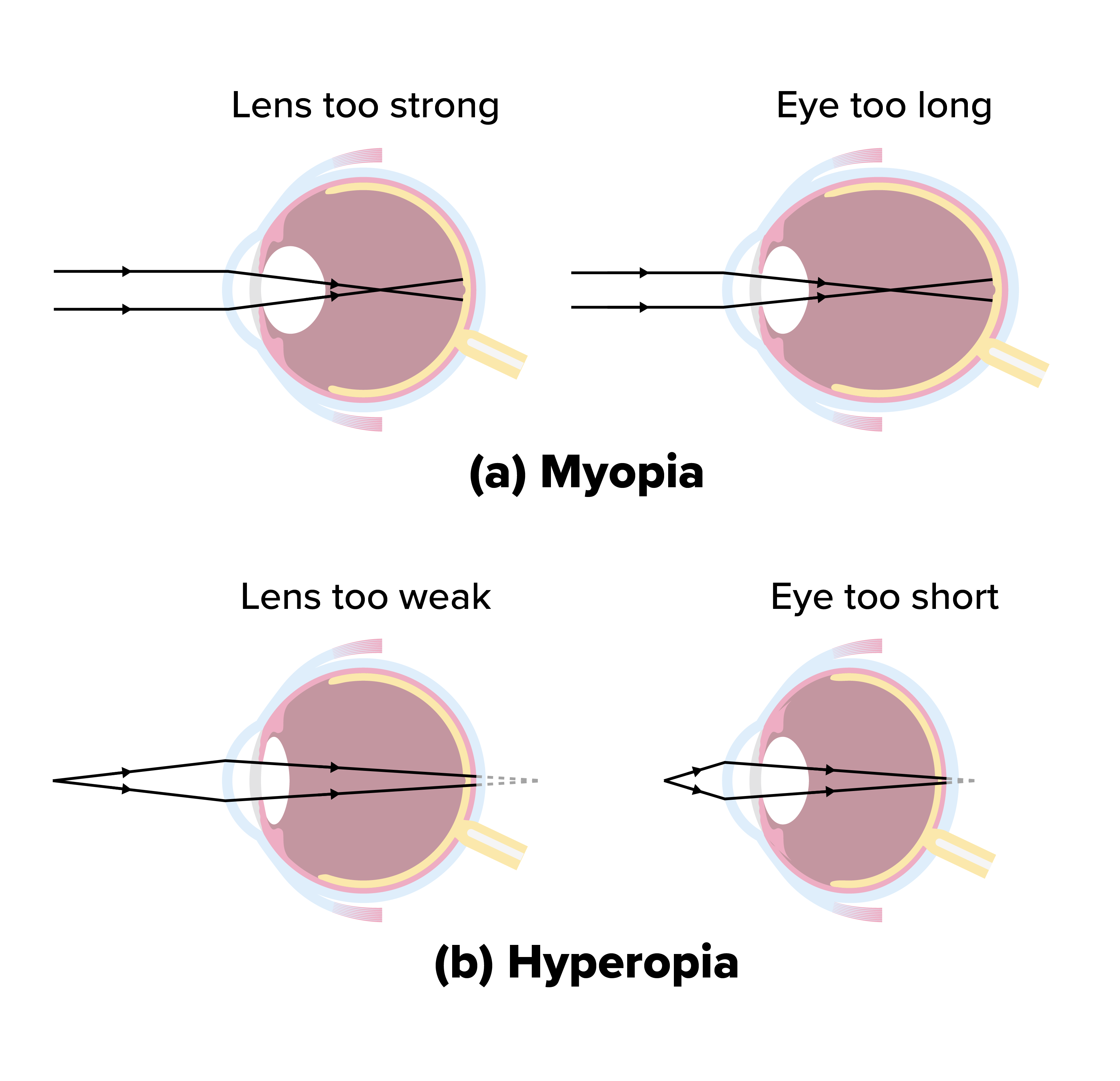 Optical Instruments Tutorial | Sophia Learning