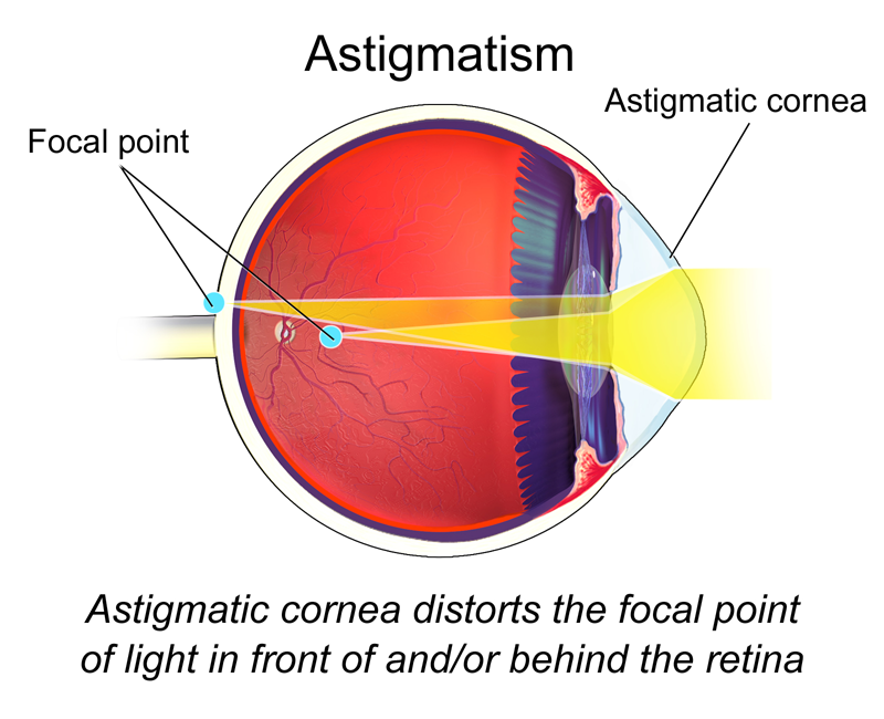 Optical Instruments Tutorial | Sophia Learning