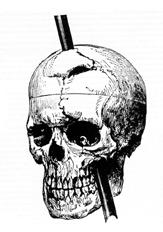 File:7449-phineas_gage.png