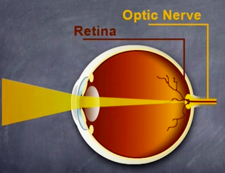 Optic Nerve